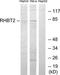 Rho Related BTB Domain Containing 2 antibody, TA315231, Origene, Western Blot image 