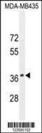 SYNCAM antibody, 55-355, ProSci, Western Blot image 