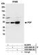Phosphoglycolate Phosphatase antibody, A305-669A-M, Bethyl Labs, Immunoprecipitation image 
