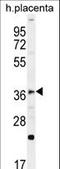 Forkhead Box I1 antibody, LS-C166226, Lifespan Biosciences, Western Blot image 