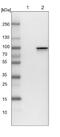 Latent membrane protein 1 antibody, NBP1-80753, Novus Biologicals, Western Blot image 