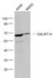 Polypeptide N-Acetylgalactosaminyltransferase 14 antibody, GTX00937, GeneTex, Western Blot image 