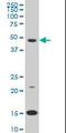 Pre-B-cell leukemia transcription factor 3 antibody, orb95179, Biorbyt, Western Blot image 