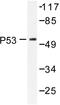 p53 antibody, AP06551PU-N, Origene, Western Blot image 
