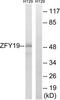 Zinc finger FYVE domain-containing protein 19 antibody, TA315945, Origene, Western Blot image 