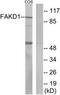 FAST Kinase Domains 1 antibody, TA315799, Origene, Western Blot image 