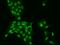 Sister chromatid cohesion protein PDS5 homolog A antibody, GTX02322, GeneTex, Immunofluorescence image 