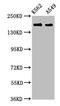 Formin 1 antibody, CSB-PA715012LA01HU, Cusabio, Western Blot image 