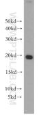M-Phase Phosphoprotein 6 antibody, 10695-1-AP, Proteintech Group, Western Blot image 
