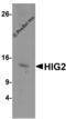 HIG1 Hypoxia Inducible Domain Family Member 2A antibody, 6491, ProSci, Western Blot image 