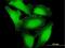 DNA dC->dU-editing enzyme APOBEC-3H antibody, H00164668-B01P, Novus Biologicals, Immunocytochemistry image 
