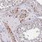 Ribonuclease P protein subunit p25 antibody, NBP1-92349, Novus Biologicals, Immunohistochemistry paraffin image 