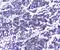 Deoxycytidine Kinase antibody, A01655-1, Boster Biological Technology, Immunohistochemistry paraffin image 