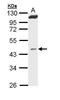 Mevalonate Diphosphate Decarboxylase antibody, TA308143, Origene, Western Blot image 
