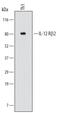 Interleukin 12 Receptor Subunit Beta 2 antibody, MAB19591, R&D Systems, Western Blot image 