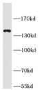 Solute carrier family 12 member 2 antibody, FNab07906, FineTest, Western Blot image 