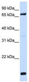 FACL4 antibody, TA338630, Origene, Western Blot image 