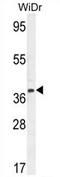 Transcription Factor B2, Mitochondrial antibody, AP54226PU-N, Origene, Western Blot image 