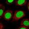 DNA repair protein complementing XP-C cells antibody, HPA035707, Atlas Antibodies, Immunofluorescence image 