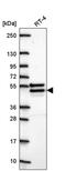 Carbohydrate Sulfotransferase 14 antibody, PA5-67187, Invitrogen Antibodies, Western Blot image 