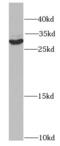 Siah E3 Ubiquitin Protein Ligase 1 antibody, FNab07857, FineTest, Western Blot image 
