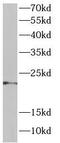 DnaJ Heat Shock Protein Family (Hsp40) Member C12 antibody, FNab02459, FineTest, Western Blot image 