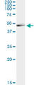 Calcium Activated Nucleotidase 1 antibody, LS-C139395, Lifespan Biosciences, Immunoprecipitation image 