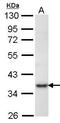 Phosphoribosyl Pyrophosphate Synthetase 1 antibody, PA5-27734, Invitrogen Antibodies, Western Blot image 
