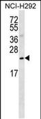 PRELI Domain Containing 3B antibody, PA5-48369, Invitrogen Antibodies, Western Blot image 