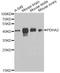 Pyruvate Dehydrogenase E1 Alpha 2 Subunit antibody, A9943, ABclonal Technology, Western Blot image 