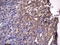 RSPO3 antibody, LS-C798184, Lifespan Biosciences, Immunohistochemistry paraffin image 
