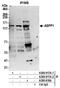 Protein Phosphatase 1 Regulatory Subunit 13B antibody, A300-917A, Bethyl Labs, Immunoprecipitation image 