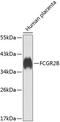 Fc Fragment Of IgG Receptor IIb antibody, A01690, Boster Biological Technology, Western Blot image 