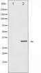 Cyclin Dependent Kinase 2 antibody, TA325342, Origene, Western Blot image 