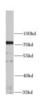 Interferon Alpha And Beta Receptor Subunit 1 antibody, FNab04147, FineTest, Western Blot image 