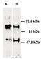ATP Binding Cassette Subfamily E Member 1 antibody, PA1-16797, Invitrogen Antibodies, Western Blot image 