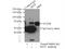 Melanocyte Inducing Transcription Factor antibody, 13092-1-AP, Proteintech Group, Immunoprecipitation image 