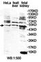 Phospholipase C Zeta 1 antibody, orb78246, Biorbyt, Western Blot image 