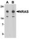 Ras antibody, TA326638, Origene, Western Blot image 