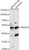 cAMP-dependent protein kinase catalytic subunit beta antibody, 16-192, ProSci, Western Blot image 