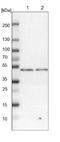 Double PHD Fingers 2 antibody, NBP1-87138, Novus Biologicals, Western Blot image 