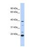Penta-EF-Hand Domain Containing 1 antibody, NBP1-56935, Novus Biologicals, Western Blot image 