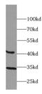 BTB Domain Containing 8 antibody, FNab00974, FineTest, Western Blot image 