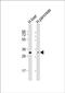 Hydroxysteroid 17-Beta Dehydrogenase 8 antibody, PA5-49501, Invitrogen Antibodies, Western Blot image 