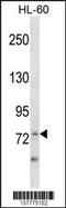 Zinc Finger And BTB Domain Containing 39 antibody, 59-829, ProSci, Western Blot image 