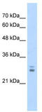 BTB/POZ domain-containing protein KCTD11 antibody, TA339052, Origene, Western Blot image 