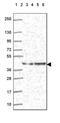 DnaJ Heat Shock Protein Family (Hsp40) Member B6 antibody, PA5-63592, Invitrogen Antibodies, Western Blot image 
