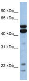 Nuclear Factor, Interleukin 3 Regulated antibody, TA329213, Origene, Western Blot image 