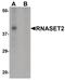Ribonuclease T2 antibody, PA5-34346, Invitrogen Antibodies, Western Blot image 