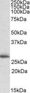 Caseinolytic Mitochondrial Matrix Peptidase Proteolytic Subunit antibody, GTX15708, GeneTex, Western Blot image 